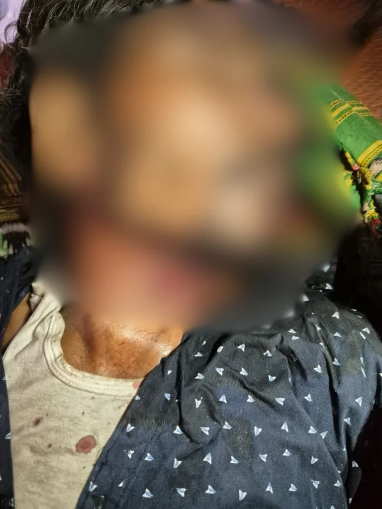 पति का गला काटकर पत्नी ने किया खौफनाक खुलासा, थाने में आत्मसमर्पण 1 Untitled design