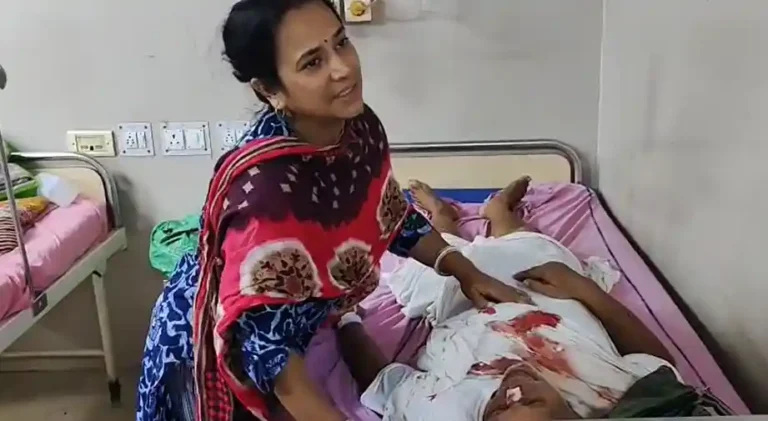 सोमवार सुबह कालना-दुर्गापुर रेलगेट के पास भयानक बस हादसा, 20 घायल 1 ezgif 2c9cbf917df156