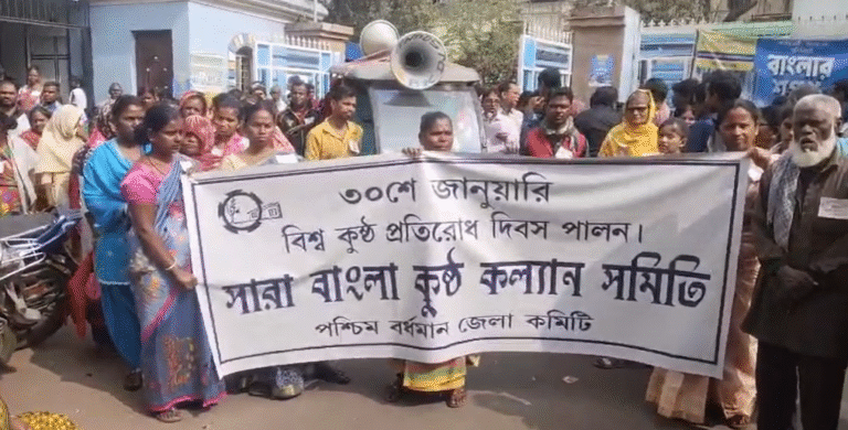 বিশ্ব কুষ্ঠ দিবসে মানবিক আবেদন, আসানসোলে মেয়রের কাছে স্মারকলিপি 1 Screenshot 2026 01 30 144457